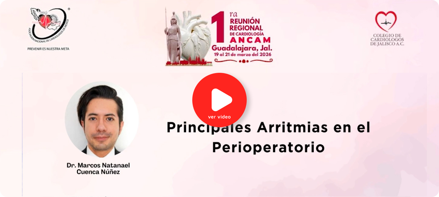 Principales arritmias en el perioperatorio